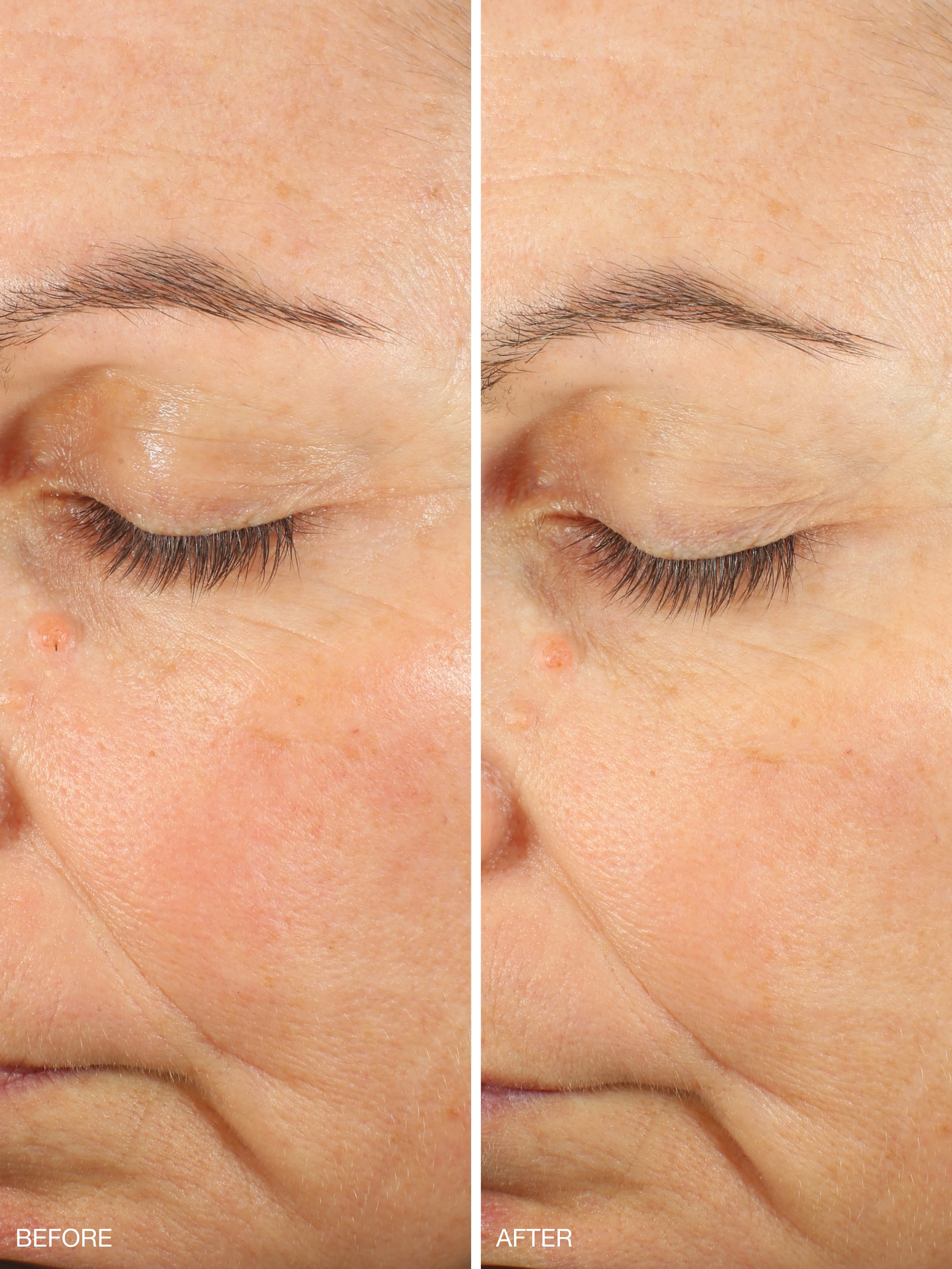 Mini - Active Collagen Wonder Serum - Image 3